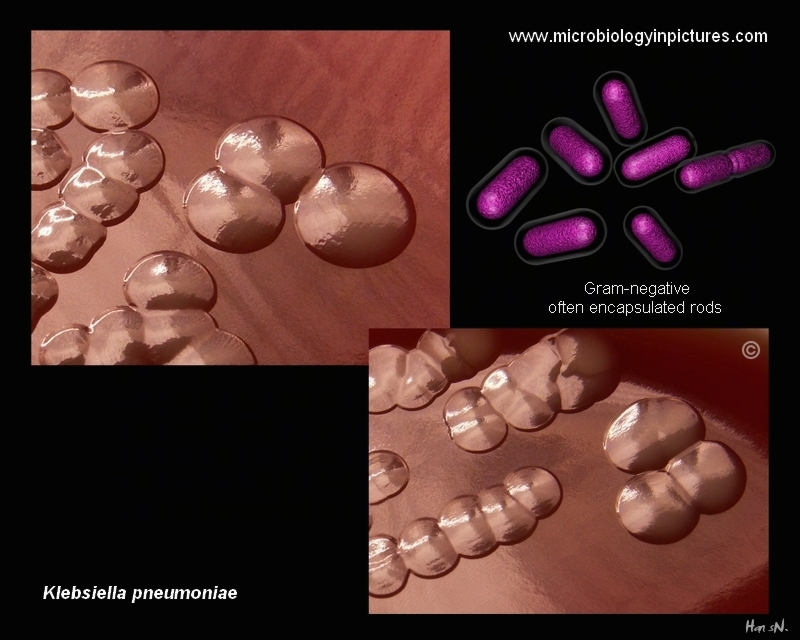Colonies of Klebsiella pneumoniae